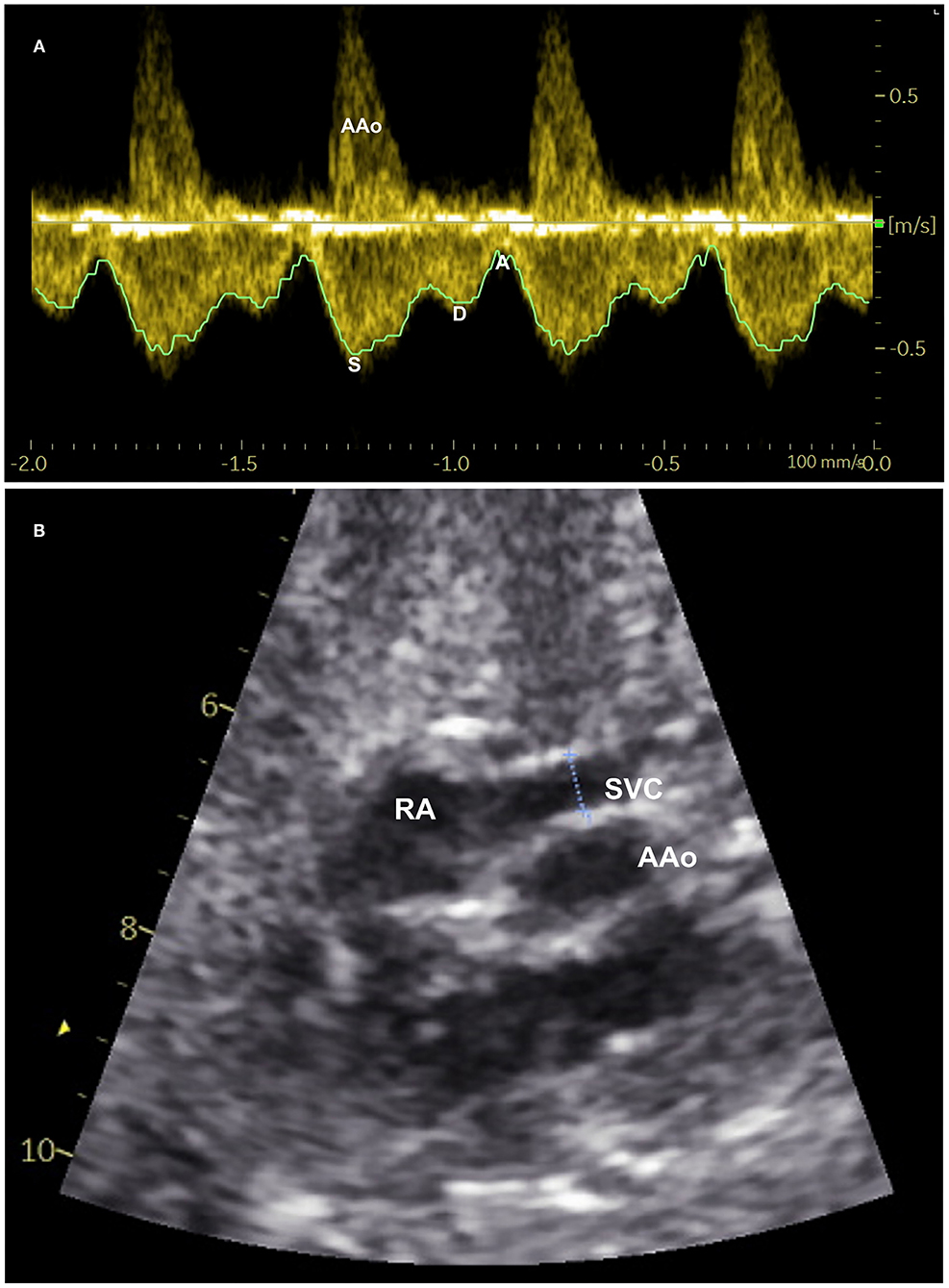 PDF) Echocardiographic Anatomy in the Fetus