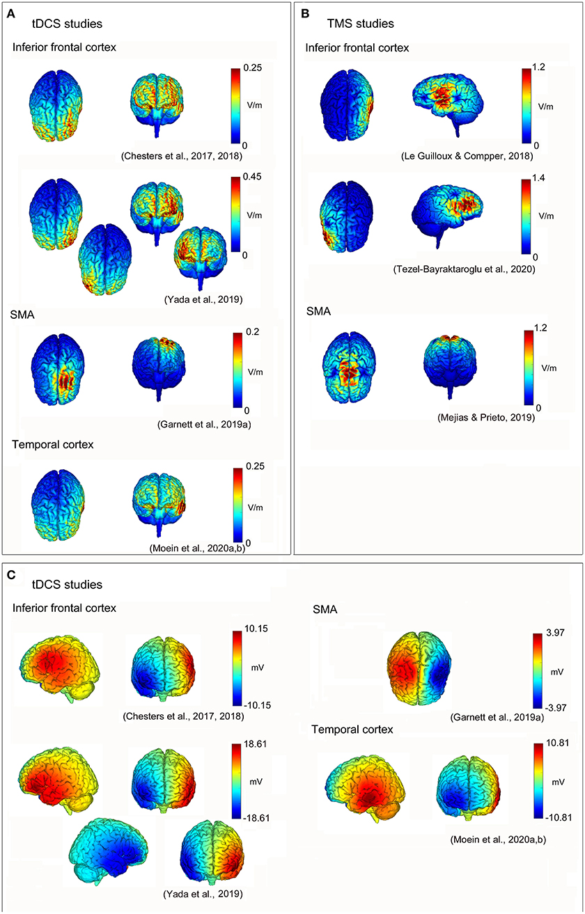 Amygdala and stuttering - Impact of Amygdala Dysfunction on Stuttering Severity