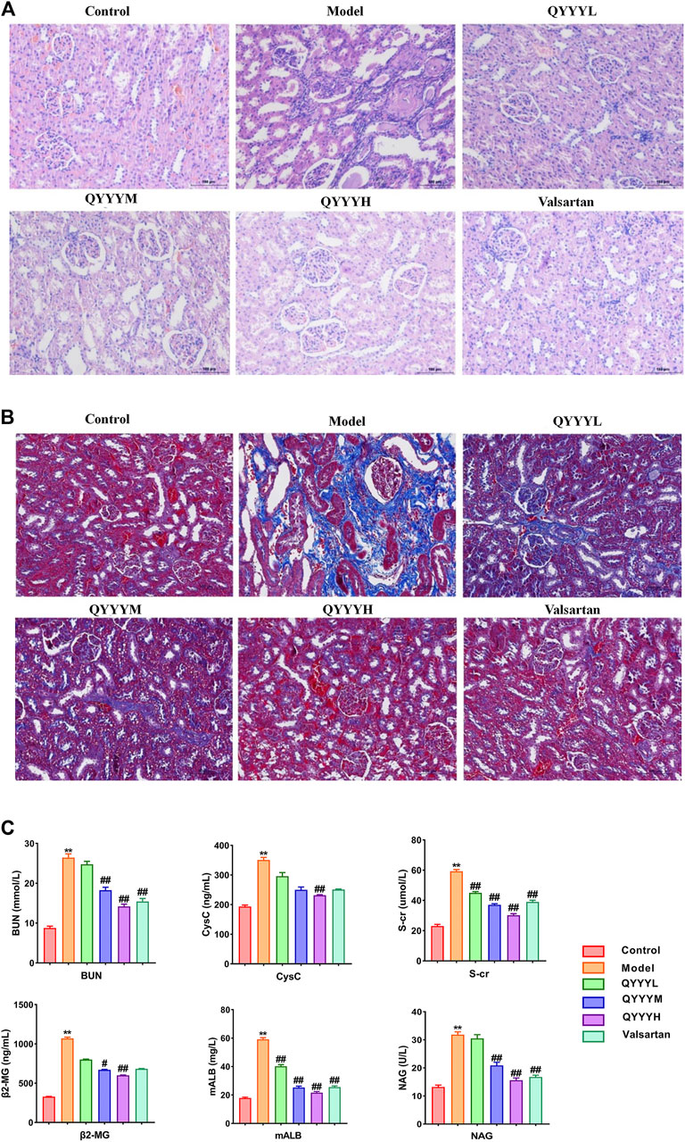 Frontiers | Qian Yang Yu Yin Granule Improves Renal Injury