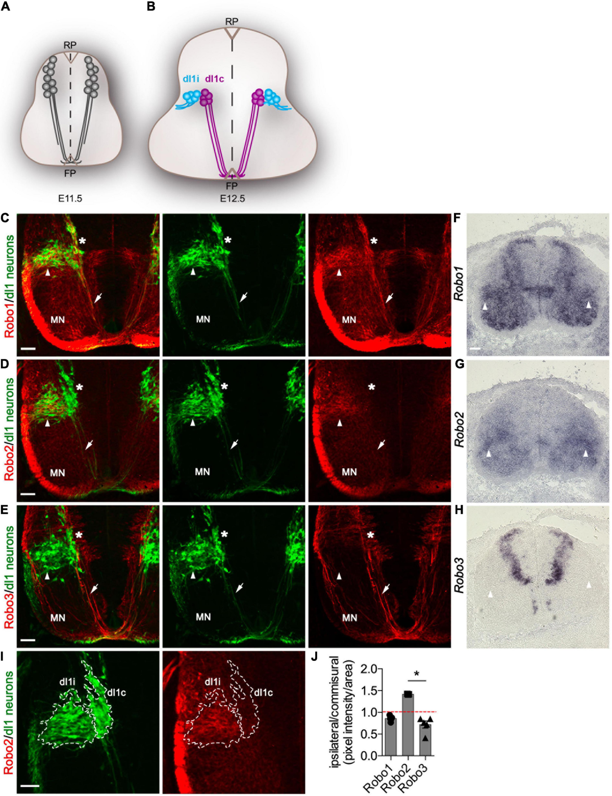 Frontiers | Robo2 Receptor Gates the Anatomical Divergence