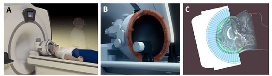 From Shaking to Steady: A Man's Journey with MRI-Guided Ultrasound - A Man's Journey with MRI-Guided Ultrasound