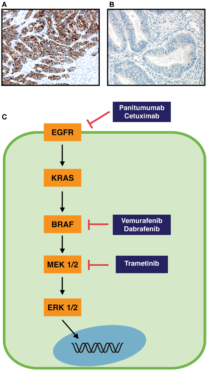 Frontiers | Toward a Molecular Classification of Colorectal Frontiers | Toward a Molecular Classification of Colorectal