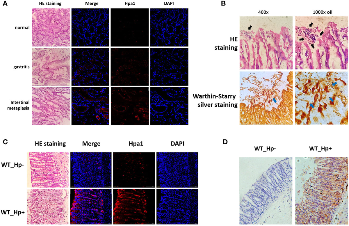 Frontiers | Helicobacter pylori-Induced Heparanase Promotes