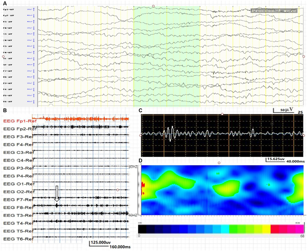 100％本物保証！ Application | Frontiers of on Oscillations High-Frequency 女性情報誌