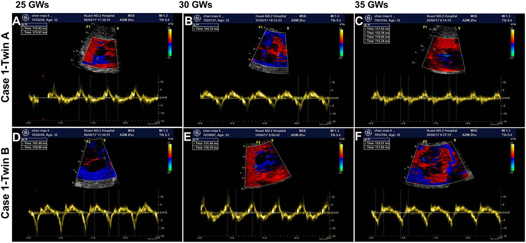 Fetology: Diagnosis and Management of the Fetal Patient