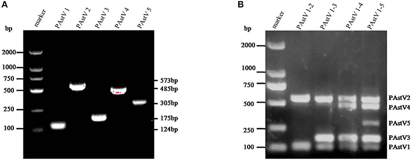 健康・医学 PCR/RT-PCRinsituLight&ElectronMicroscopy Frontiers | Establishment of a Multiplex RT-PCR Method for