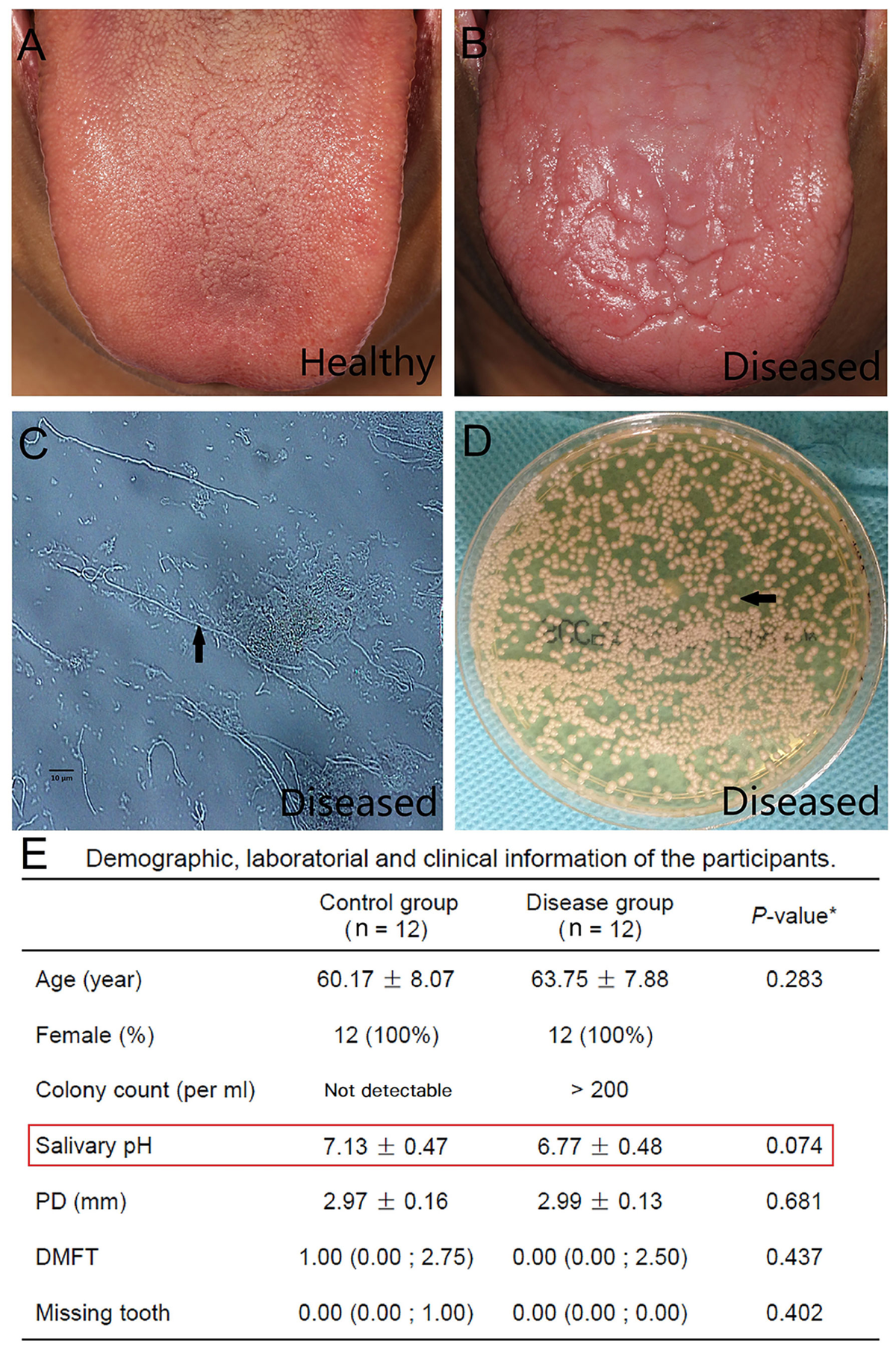 Frontiers | Oral Microbiota Composition and Function Changes