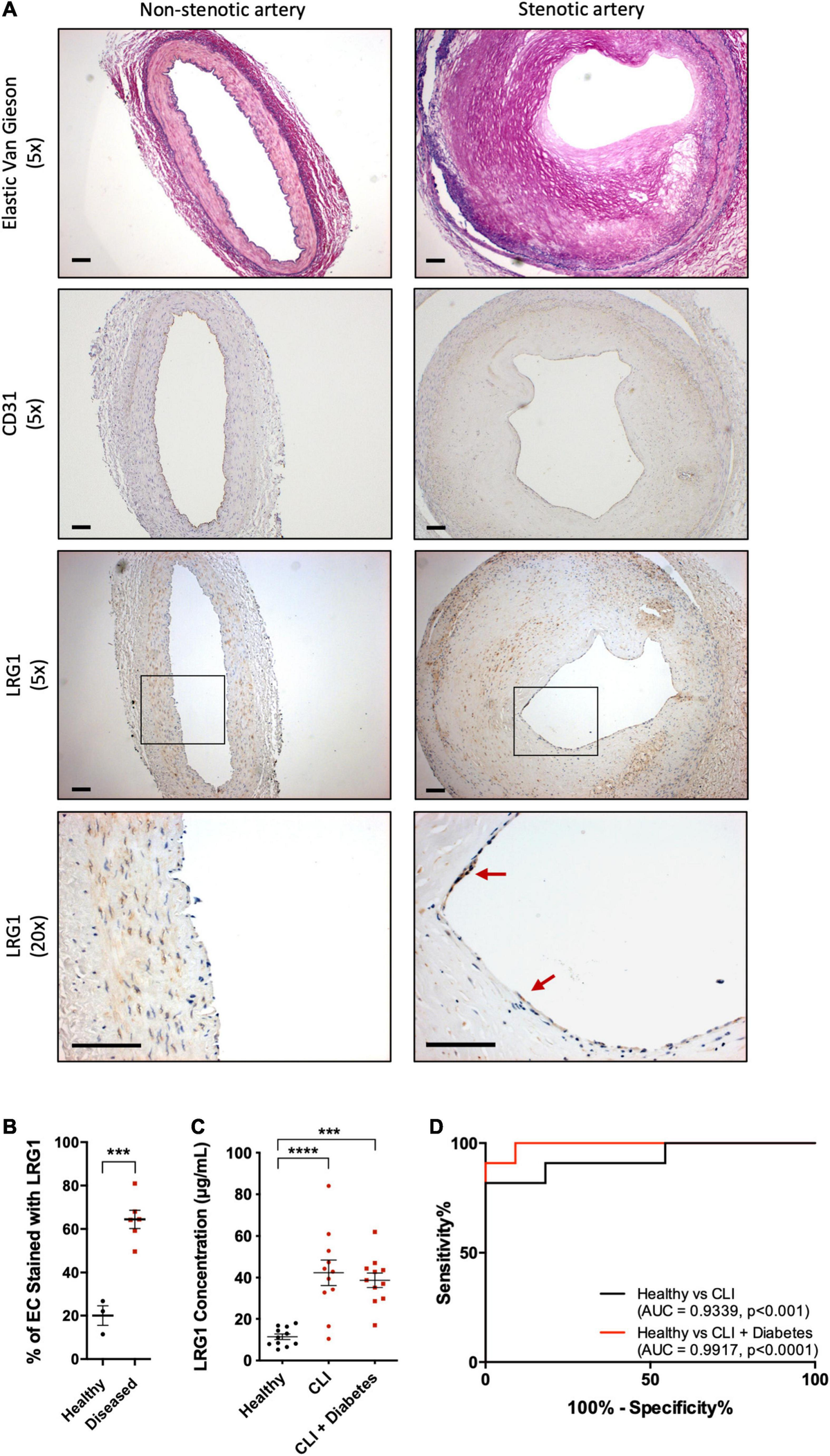 The principle of Zolbetuximab targeting CLDN18.2+ tumor