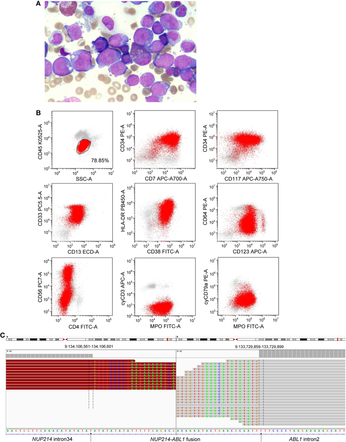 ゆん！ Gene-modified pig-to-human liver xenotransplantation | Nature