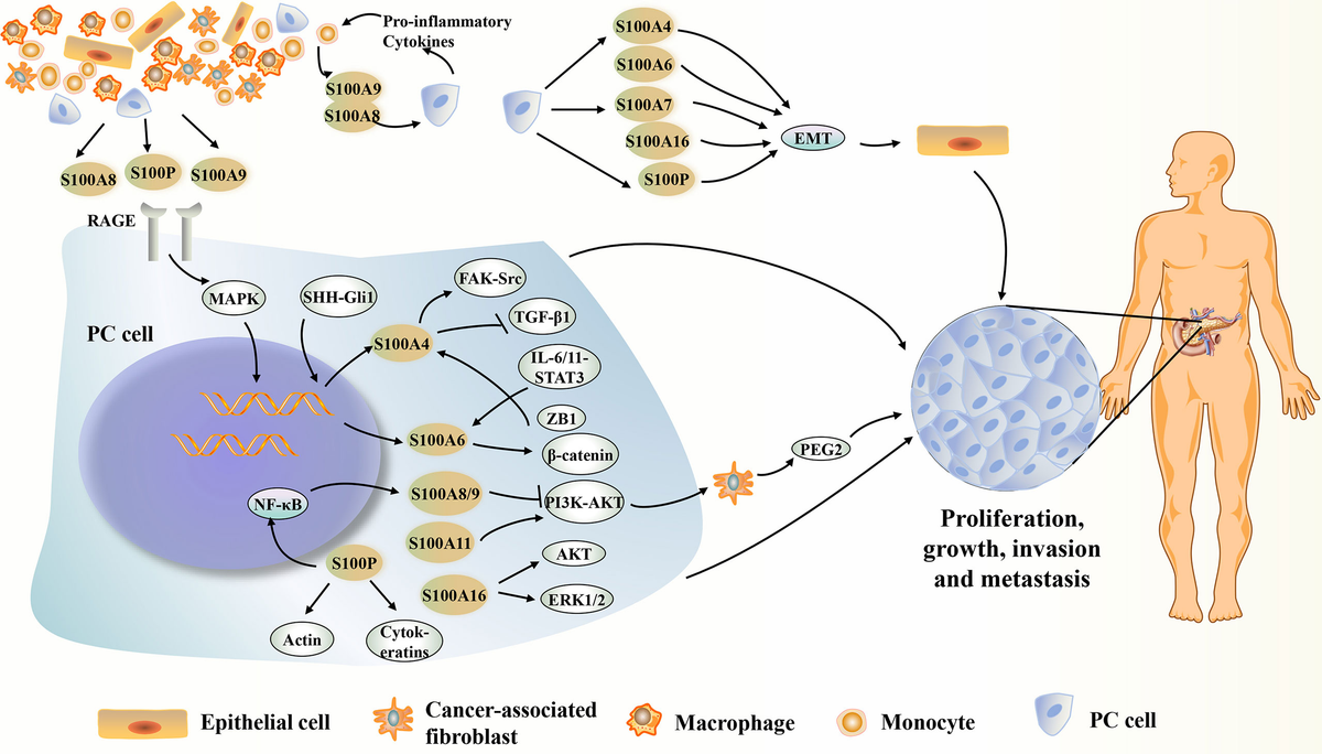 Frontiers | S100 Proteins in Pancreatic Cancer: Current