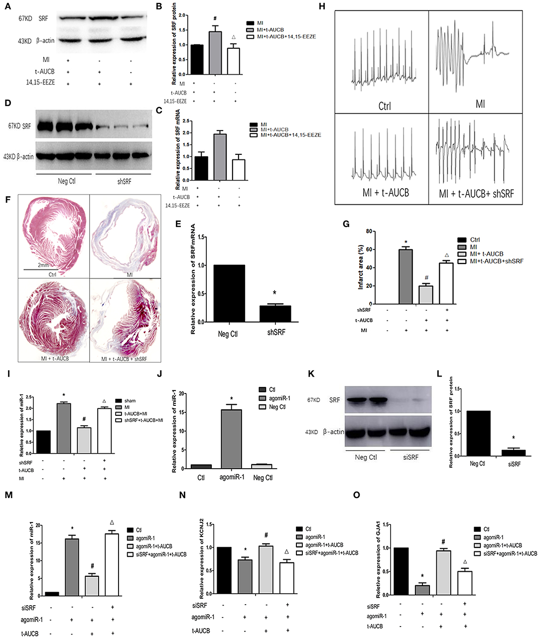 パラフィン uN2CpolyG-mediated p65 nuclear sequestration suppresses the