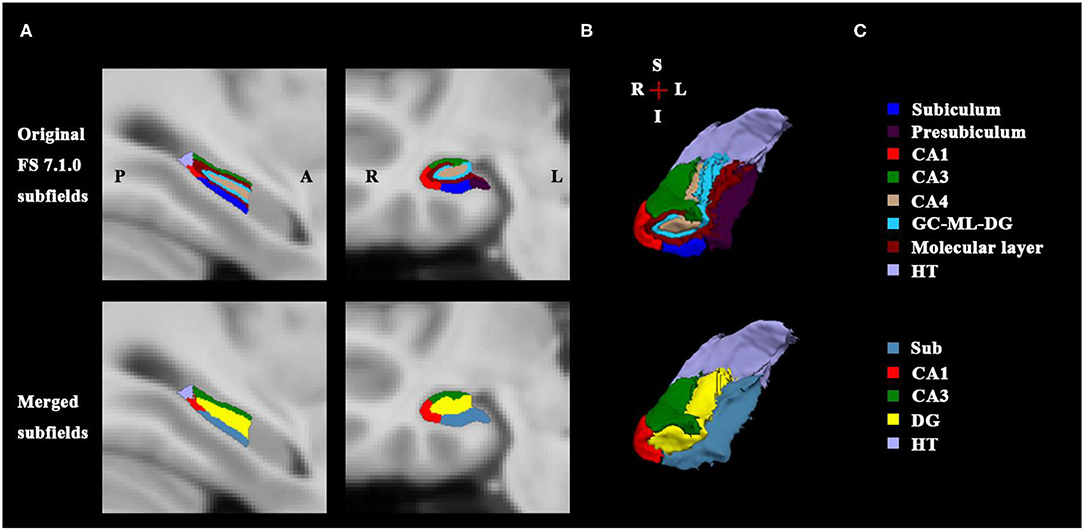 Frontiers | Disruption in Surface-Based Functional Connectivity in