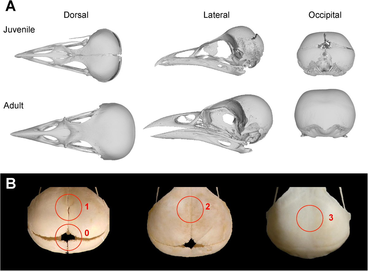 Frontiers | Common Patterns of Skull Bone Fusion and Their 