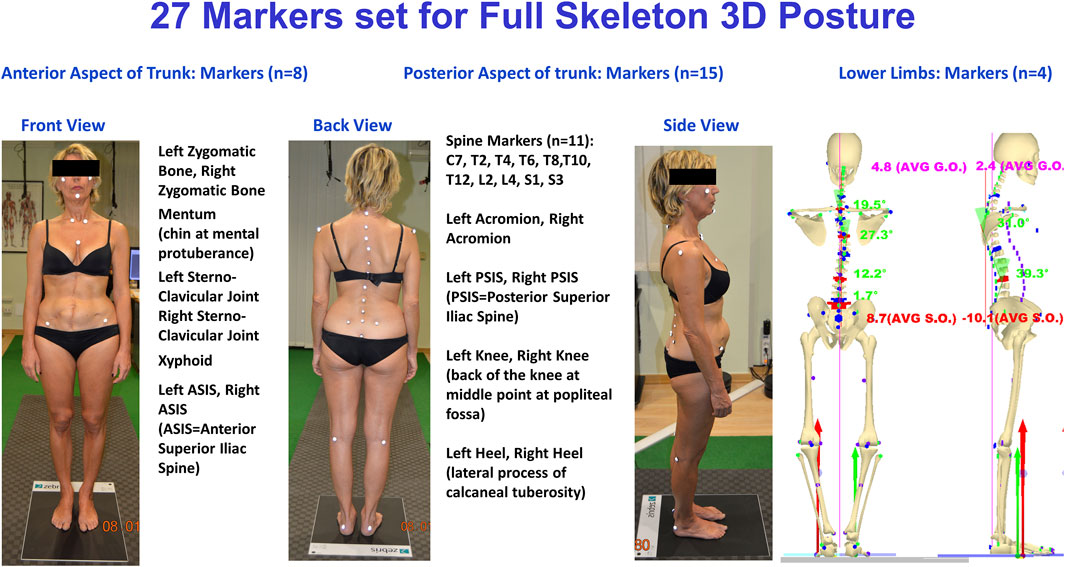 Heel lift causing hip pain new arrivals