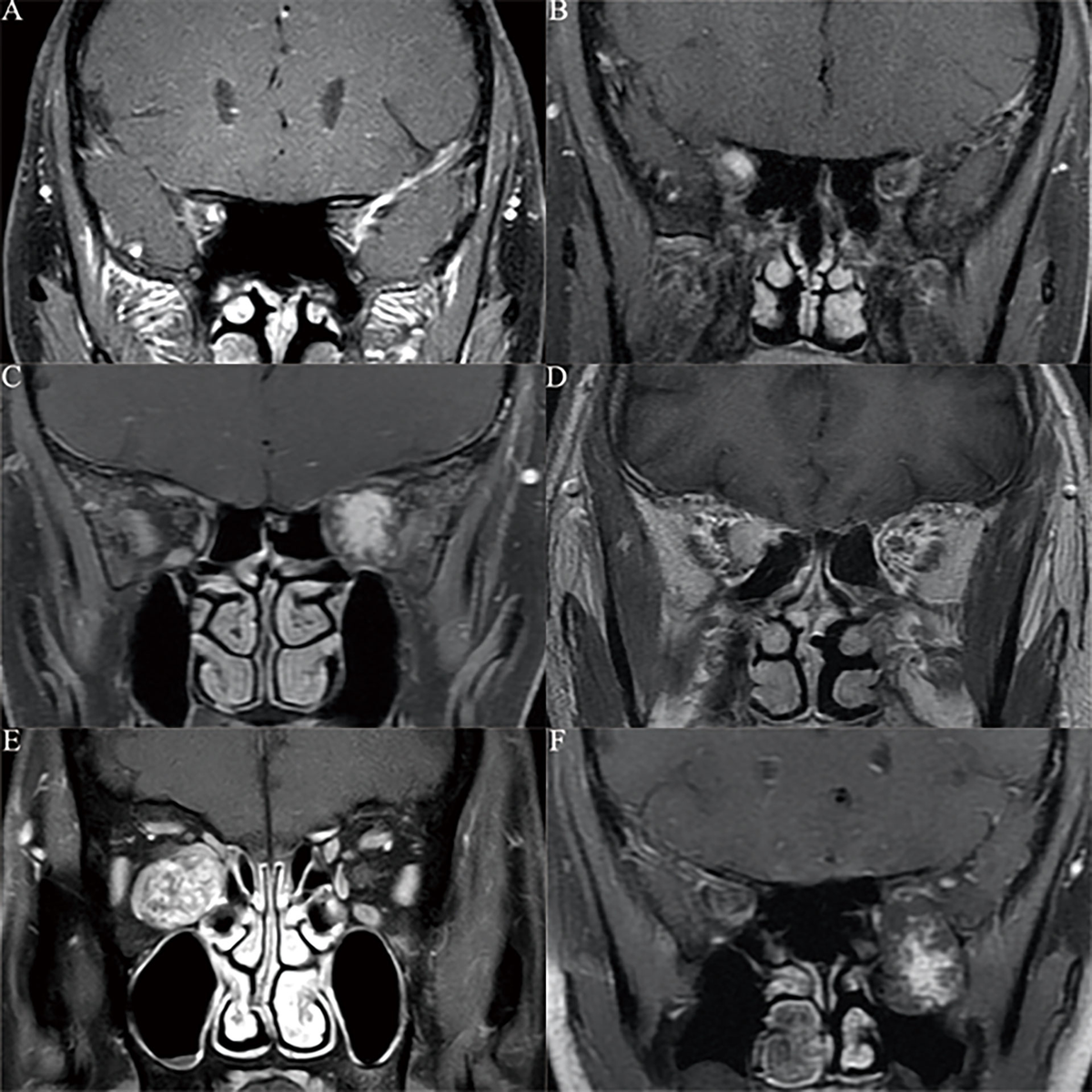 Frontiers | Prognosis Analysis and Clinical Features of