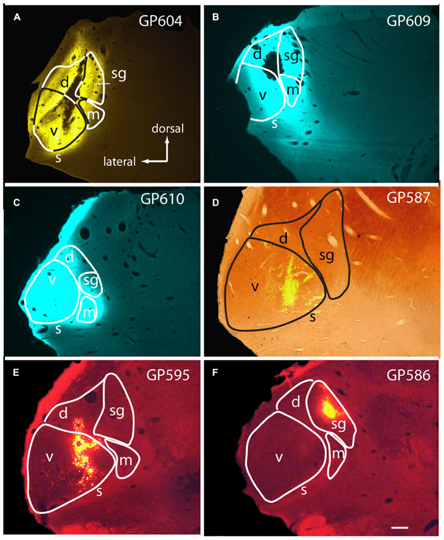  (0ｰ8)||icdn.ru nude 08 Projections from the dorsal and ventral cochlear nuclei to the medial  geniculate body - Frontiers