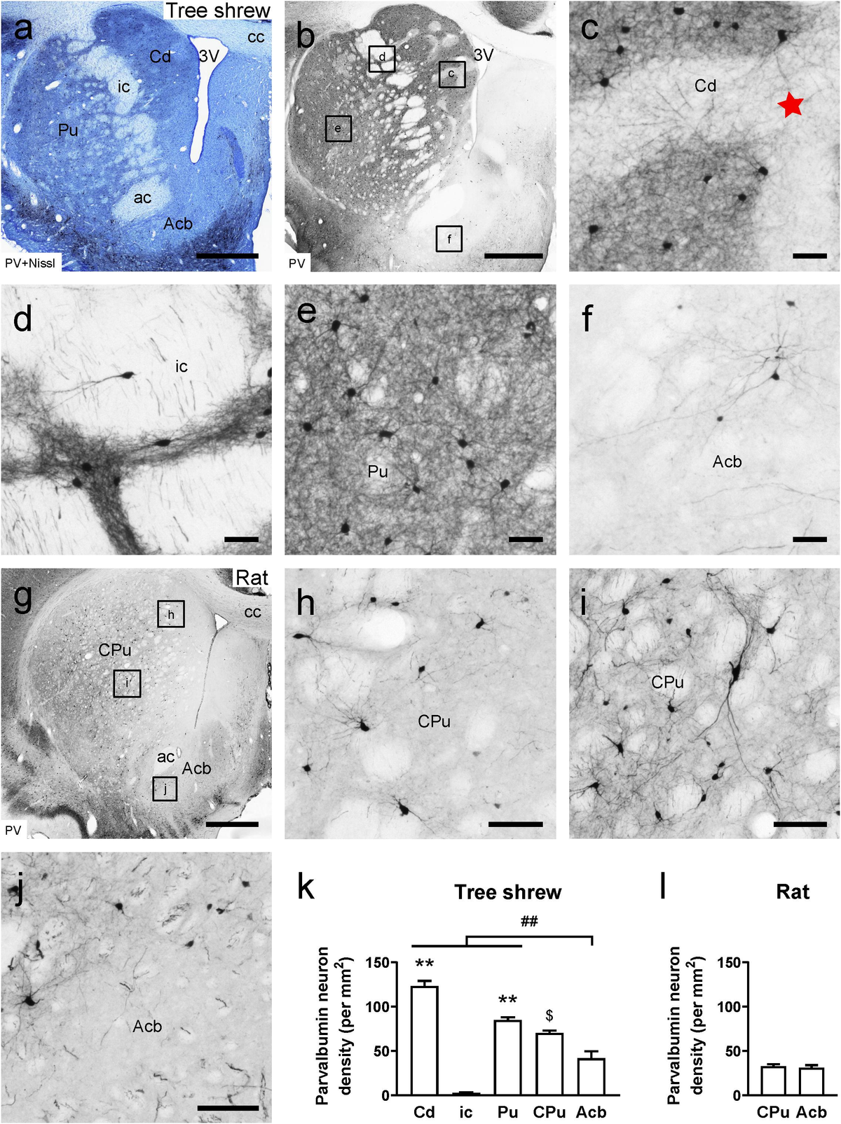 lsm.jpg4.us | imagesize: las-027 " Frontiers | Whole-Brain Afferent Inputs to the Caudate Nucleus, Putamen,  and Accumbens Nucleus in the Tree Shrew Striatum