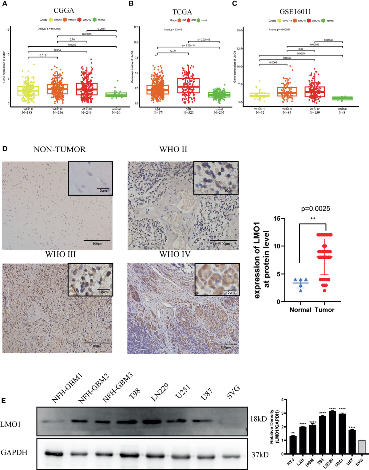 lsm nudes 015 LMO1 Plays an Oncogenic Role in Human Glioma Associated With NF-kB Pathway  - Frontiers