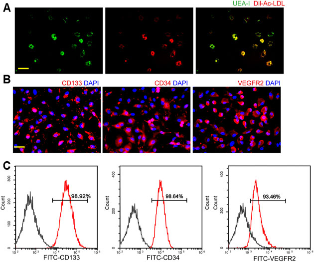 Differential MicroRNA Expression Pattern in Endothelial Progenitor ...