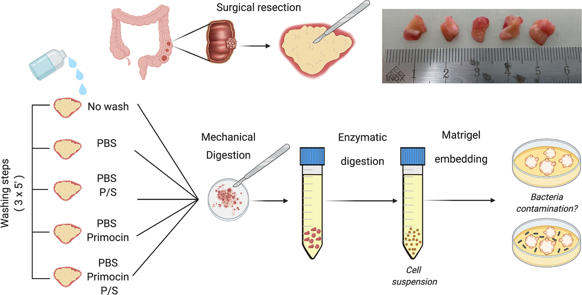 Frontiers | Standardizing Patient-Derived Organoid Generation Workflow ...