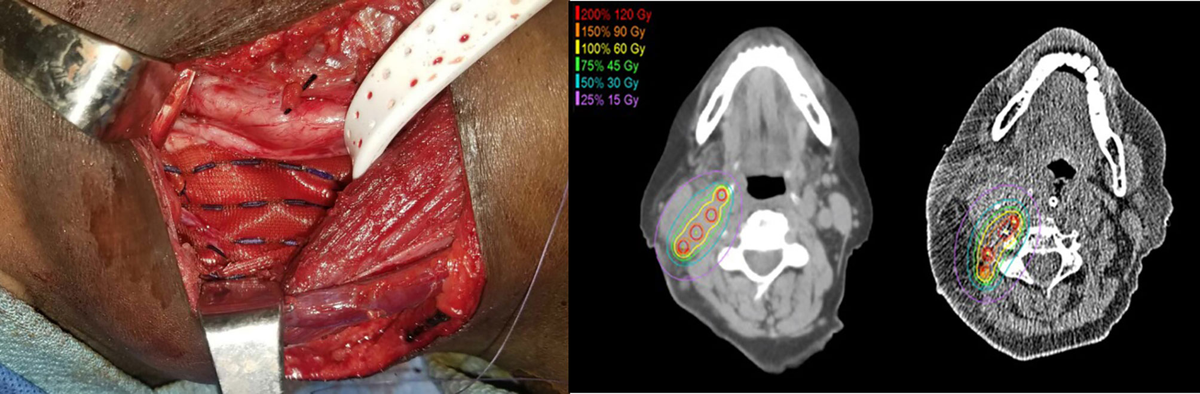 裁断済 臨床頭頸部癌学 = Clinical Head and Neck On Clinical