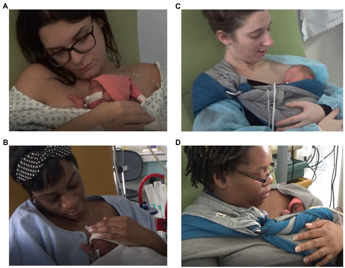 icdn.ru daughter naked(' " Skin-to-skin SDF positioning: The key to intersubjective intimacy between  mother and very preterm newborn—A pilot matched-pair case-control study -  Frontiers