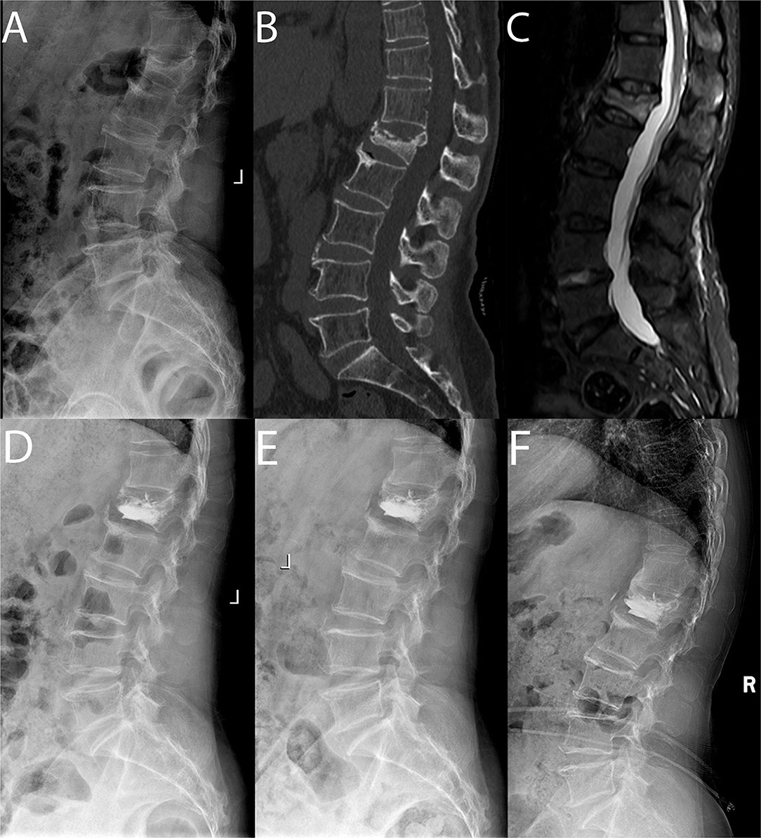 Fractured Skull Compensation Long Beach thumbnail