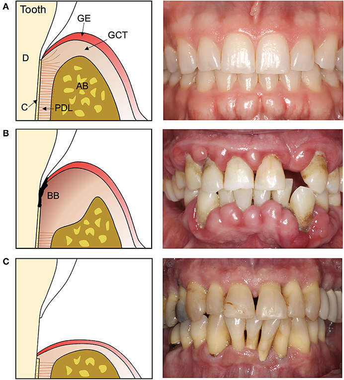 歯周治療プラクティスマニュアル = Periodontal therapy :… Periodontal Microsurgeryの実践講座 | Doctorbook academy