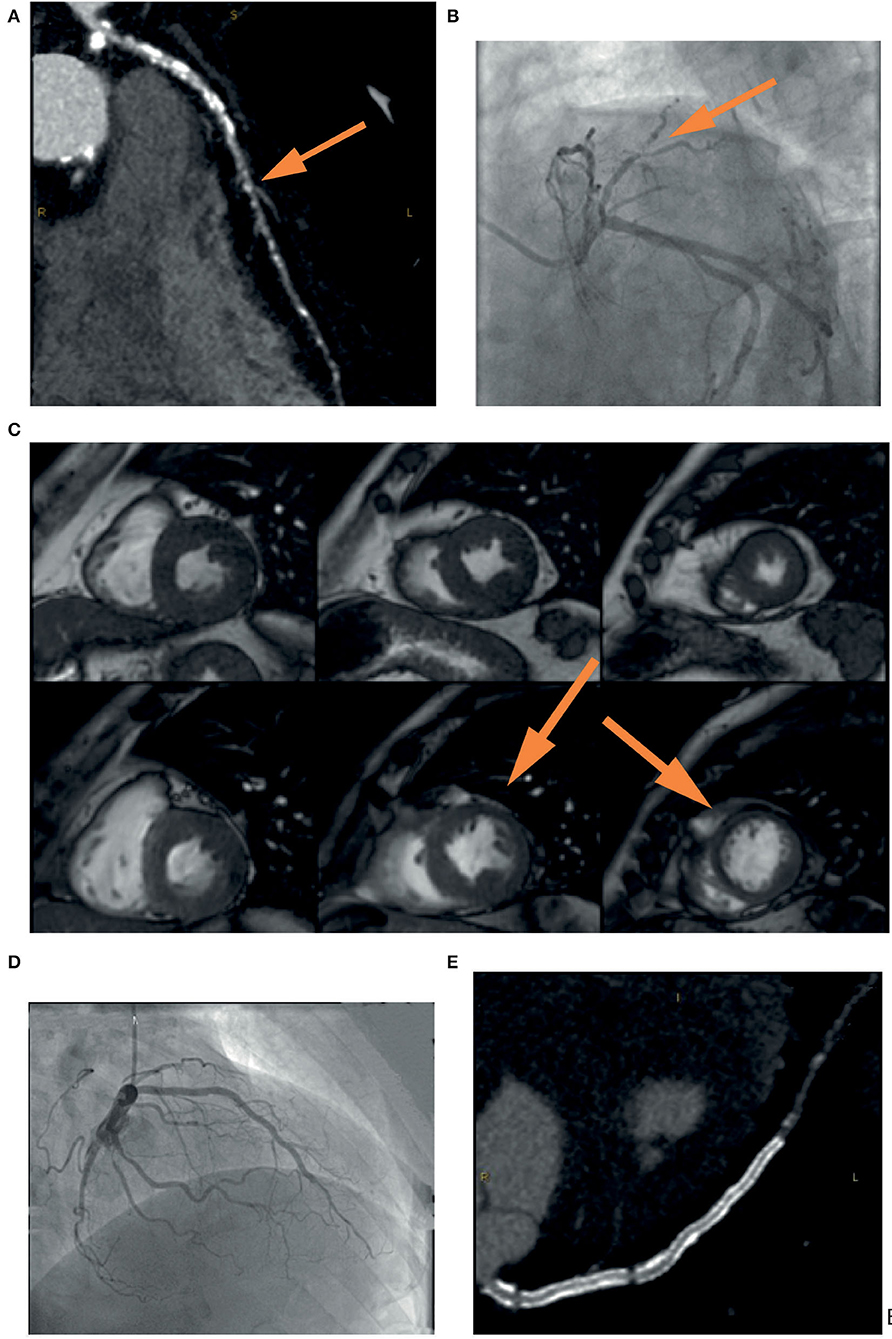【内祝い】 Frontiers | for Imaging Multimodality of Role The 制汗・デオドラント