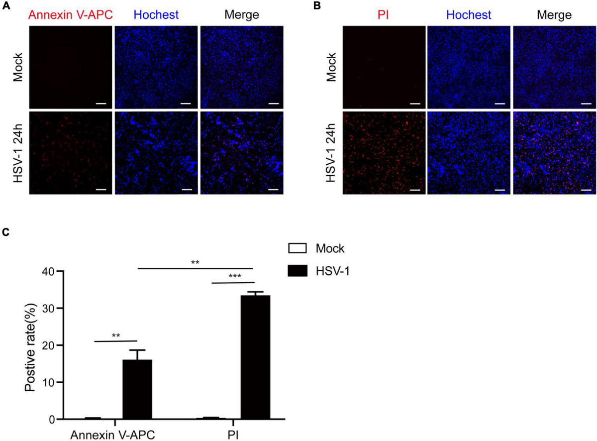 Frontiers | Herpes Simplex Virus 1 Induces Microglia