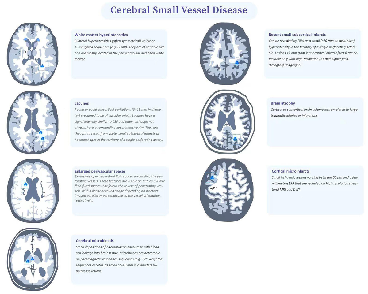 Frontiers | Clinical, Radiological and Pathological 