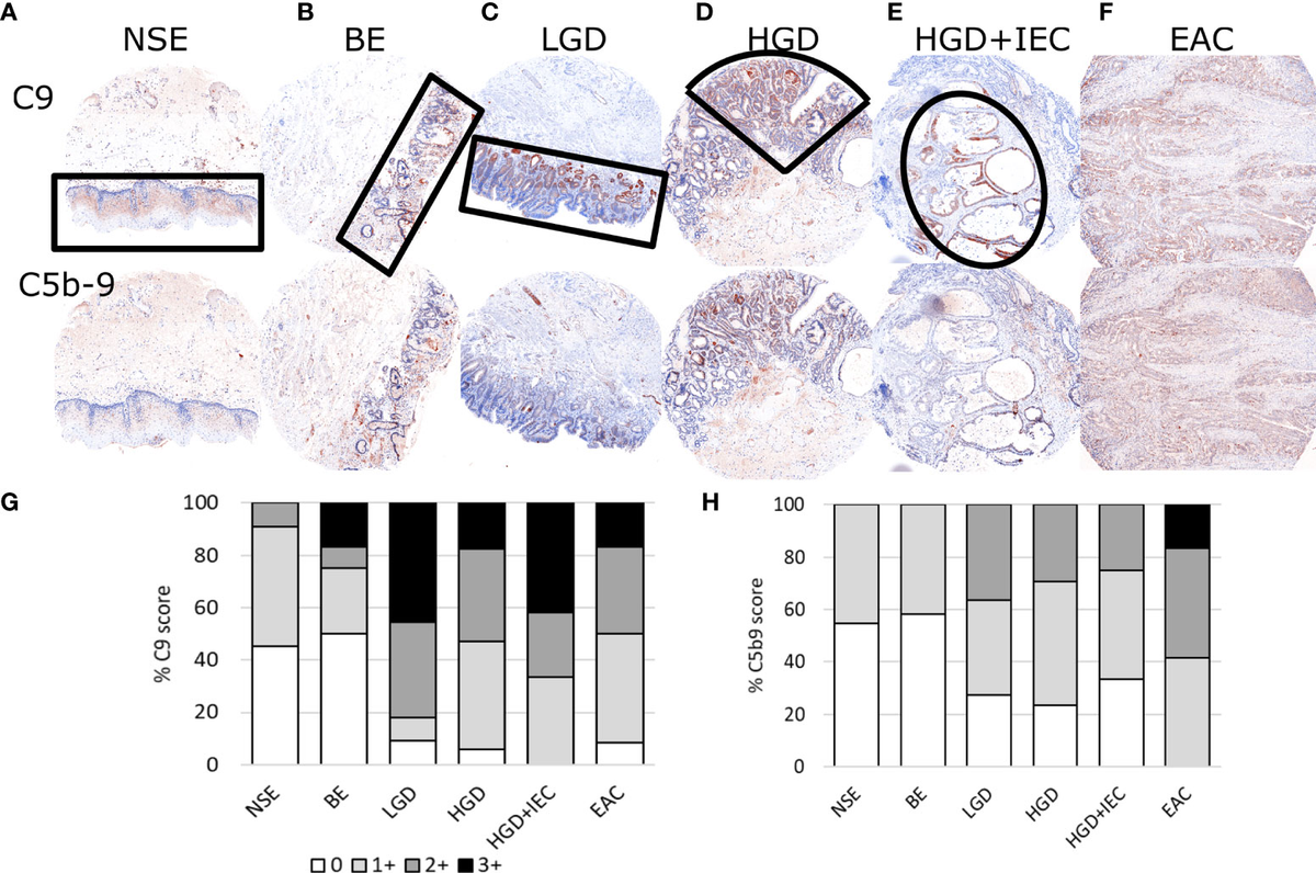 Frontiers | C5b-9 Membrane Attack Complex Formation and