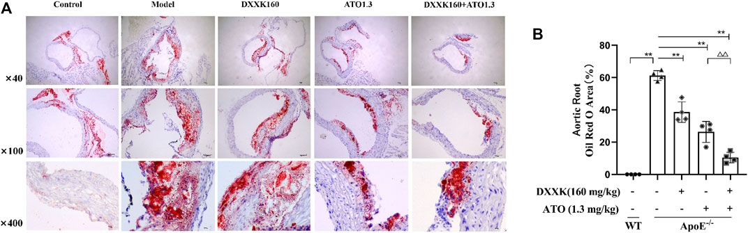 Frontiers | Di'ao Xinxuekang Capsule Improves the Anti