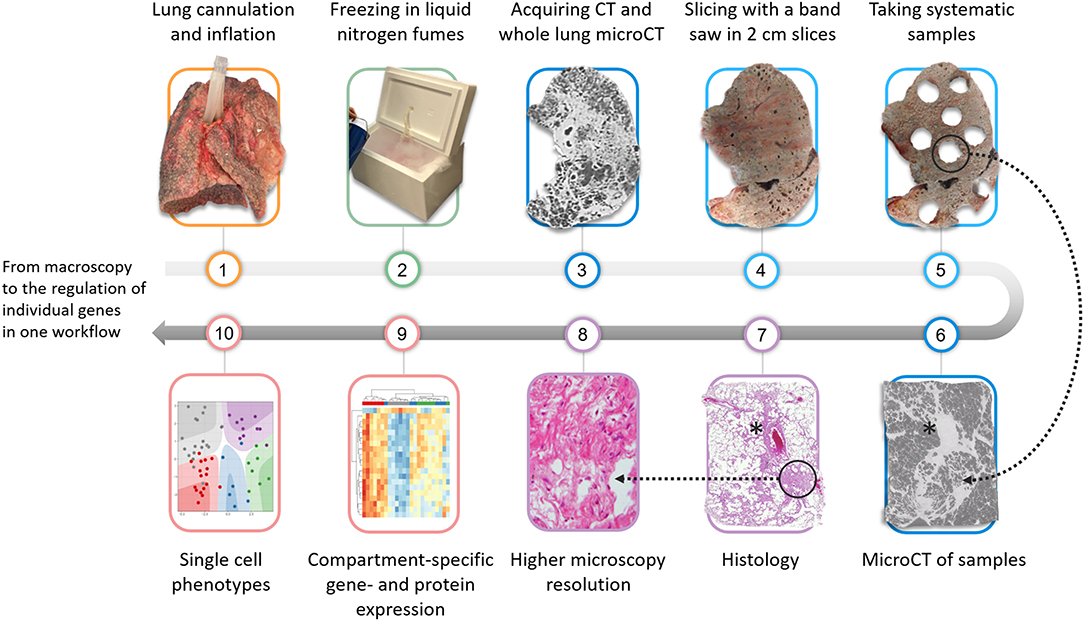 Diffuse Lung Diseases: Clinical Features, Pathology, HRCT