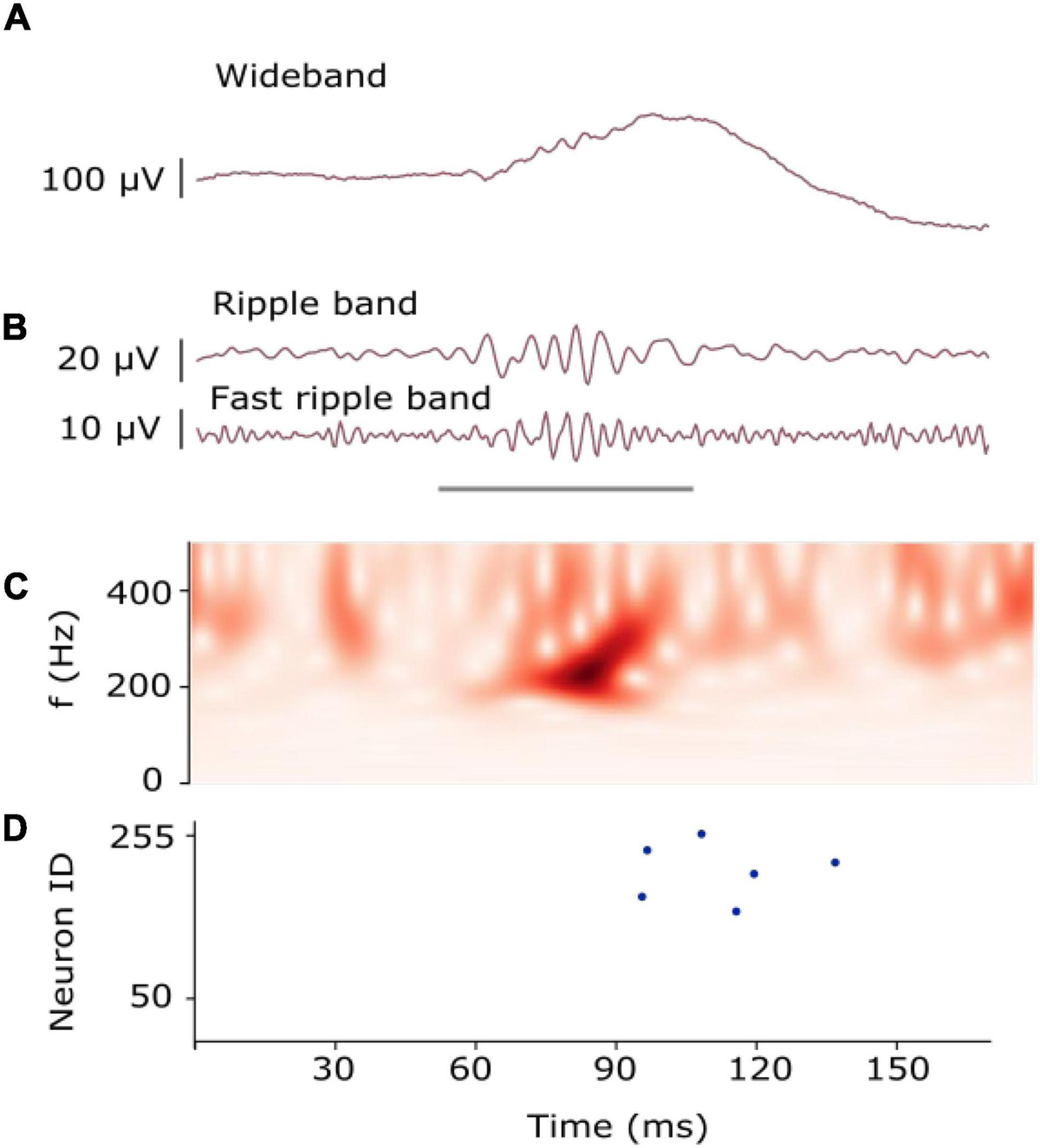 EEG montage with channels indicated. Channel numbers for