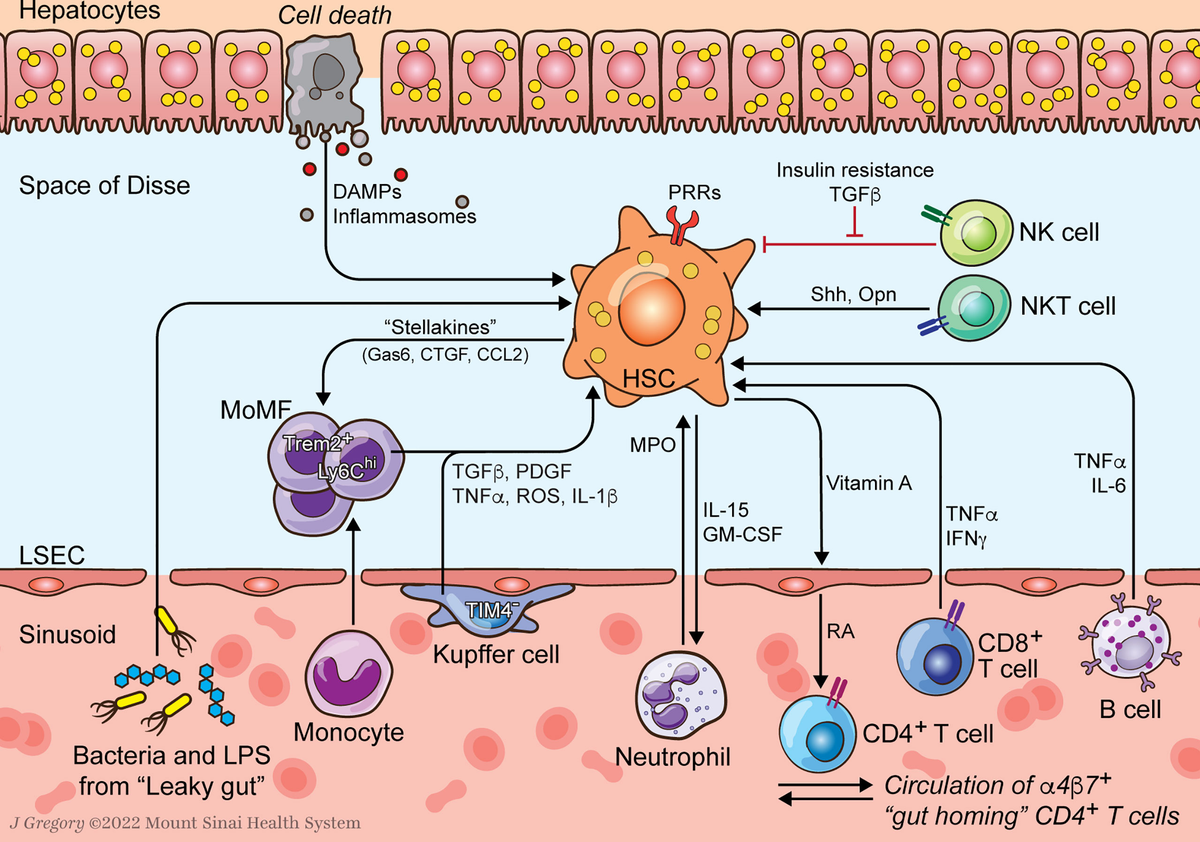 Frontiers | Hepatic Stellate Cell-Immune Interactions in NASH