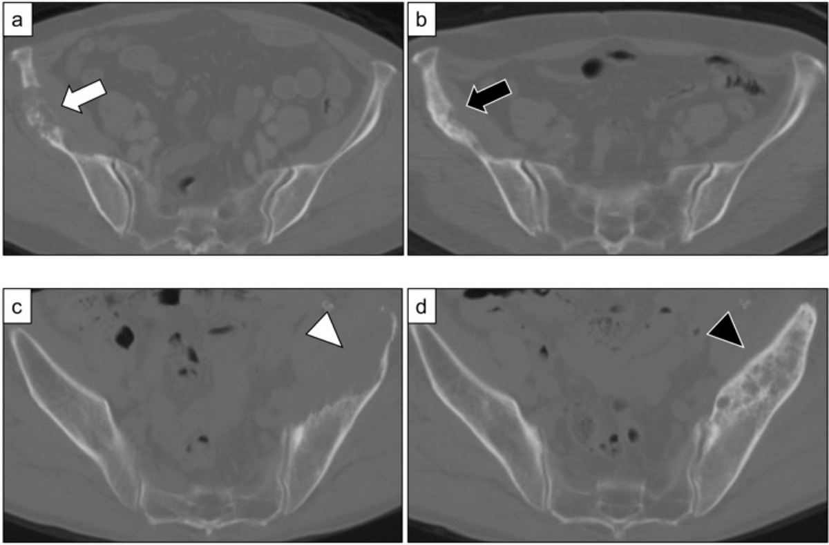 Veterinary Oncology　No.11 疾患鑑別リスト Veterinary Oncology No.11 疾患鑑別リスト Veterinary Oncology