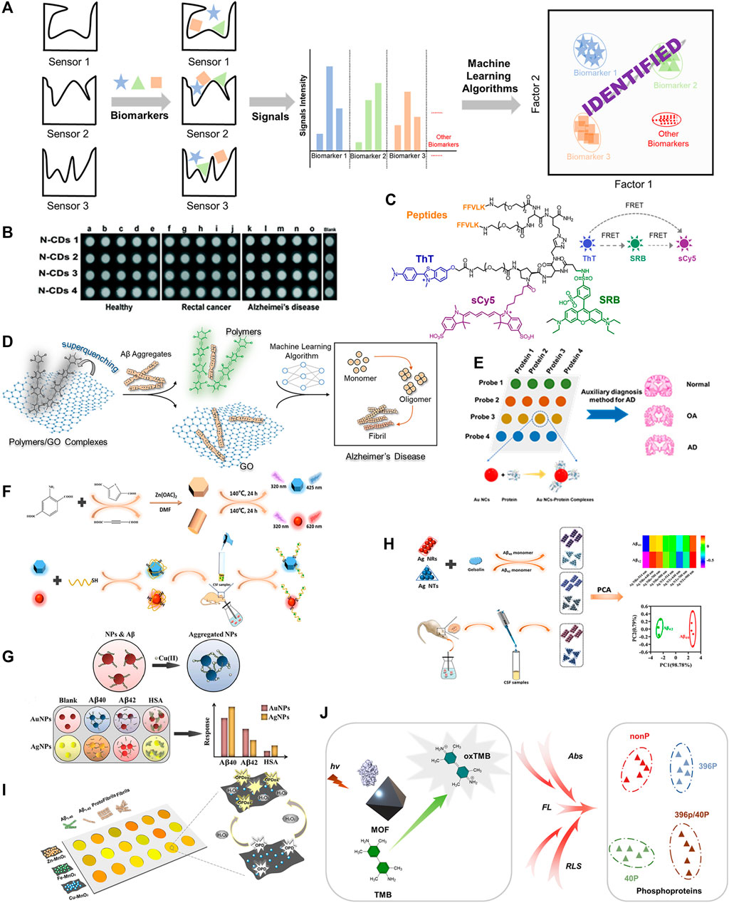Frontiers | Optical Sensor Array for the Early Diagnosis of Alzheimer’s ...
