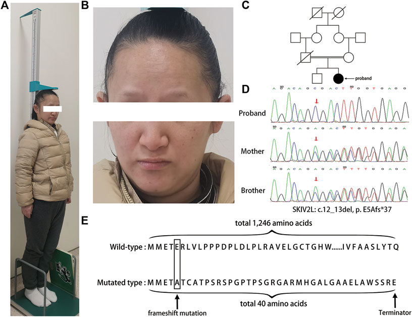 【裁断済】Pocket knowledge for eye disease 2n Single-nucleus DNA sequencing reveals hidden somatic loss-of