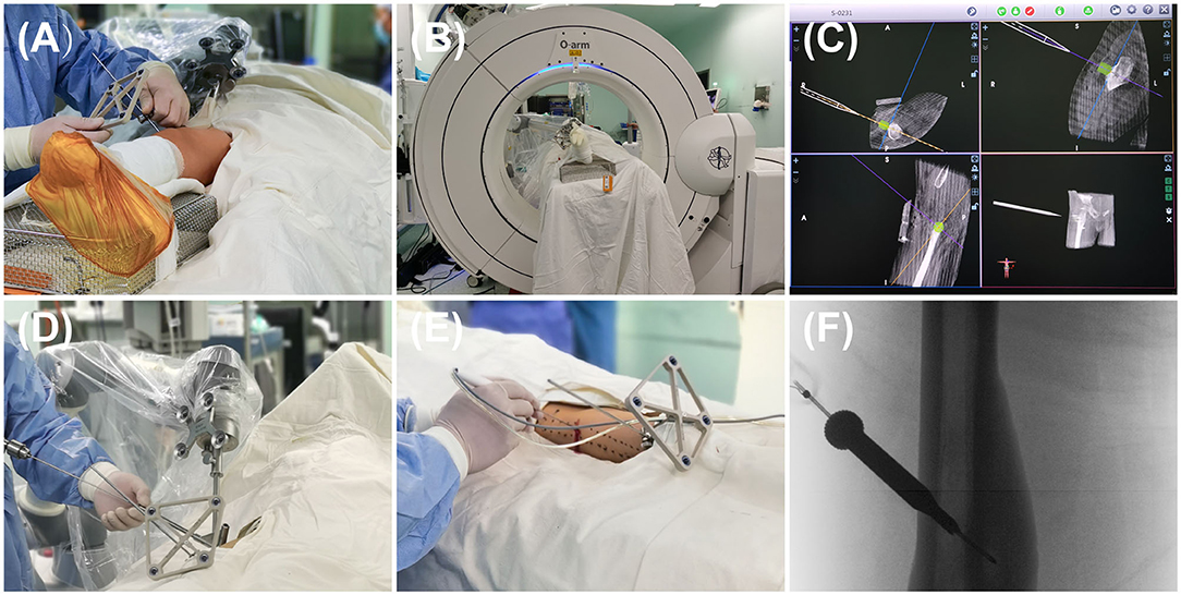 コンパス顔面骨骨折の治療 : Clinical Operation Manua… コンパス顔面骨骨折の治療 ベーシック編 | 坂本好昭 |本 | 通販