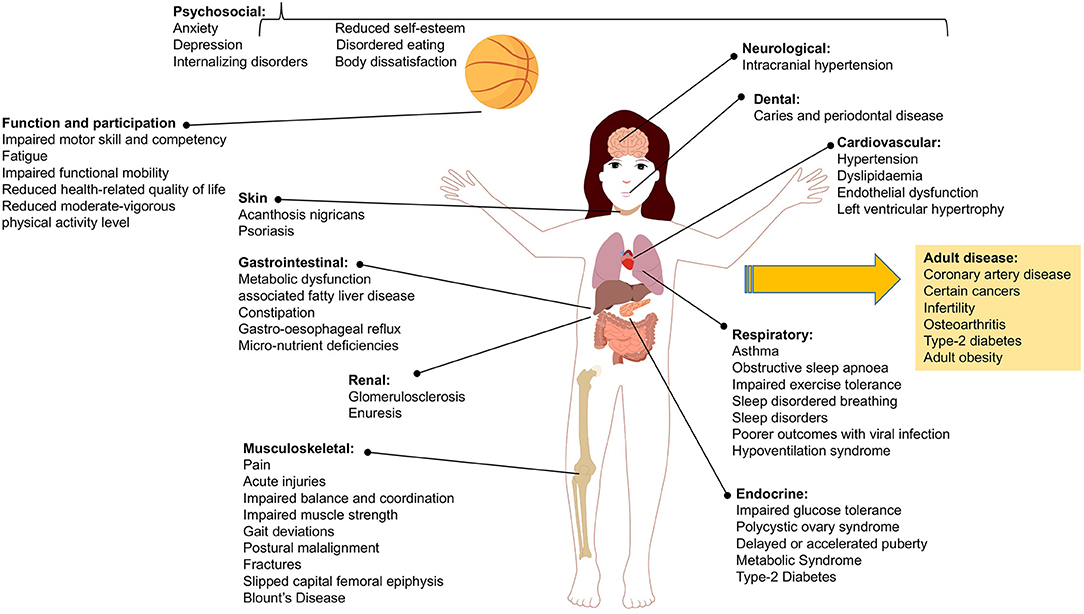 Evaluating 12 Years of Implementing a Multidisciplinary Specialist Child and Adolescent Obesity Treatment Service: Patient-Level Outcomes