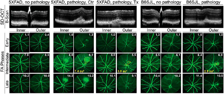 Frontiers | Low-Dose Anti-HIV Drug Efavirenz Mitigates
