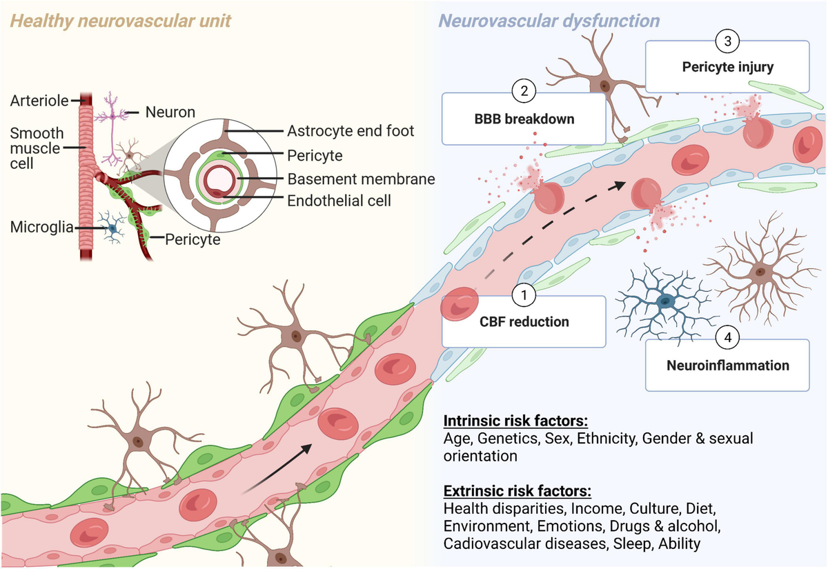 Decision Making in Neurovascular Disease: 9781684200573