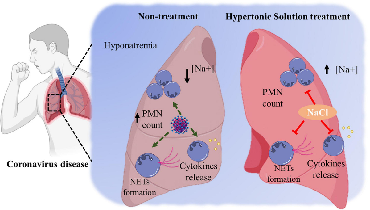 高評価レビュー in Solution Hypertonic | Frontiers Severe Patient COVID-19 その他