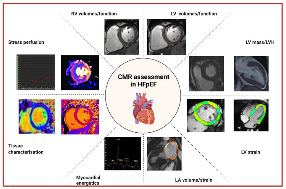 Frontiers The role of cardiac magnetic resonance imaging in the