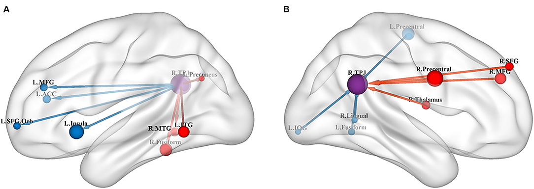 Frontiers | The Atypical Effective Connectivity of Right