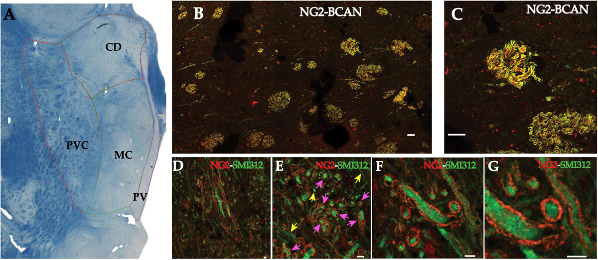 R‐spondins/Lgrs expression in tooth development - kawasaki