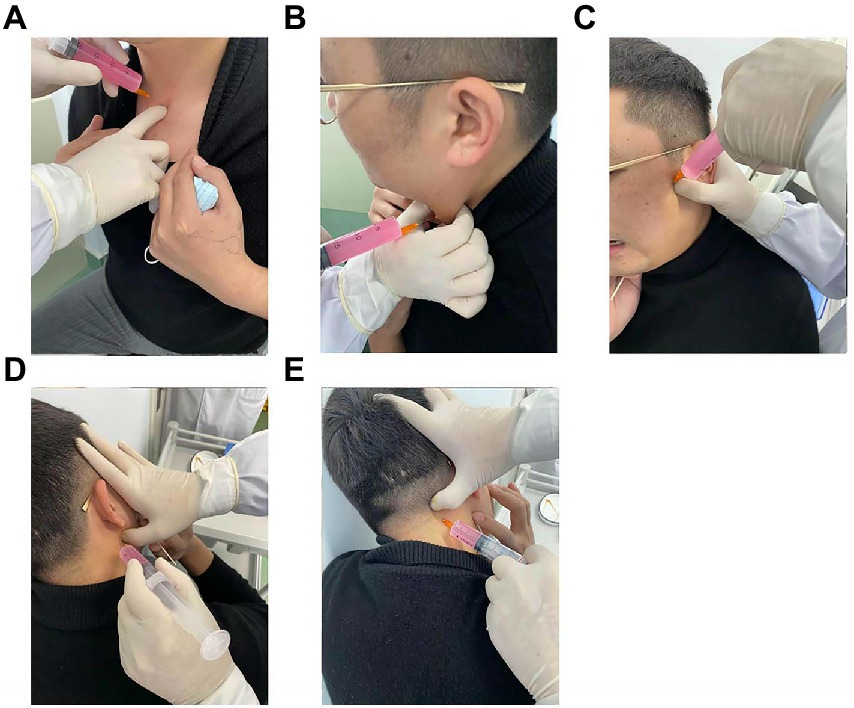 Frontiers | Latent myofascial trigger points injection therapy for ...