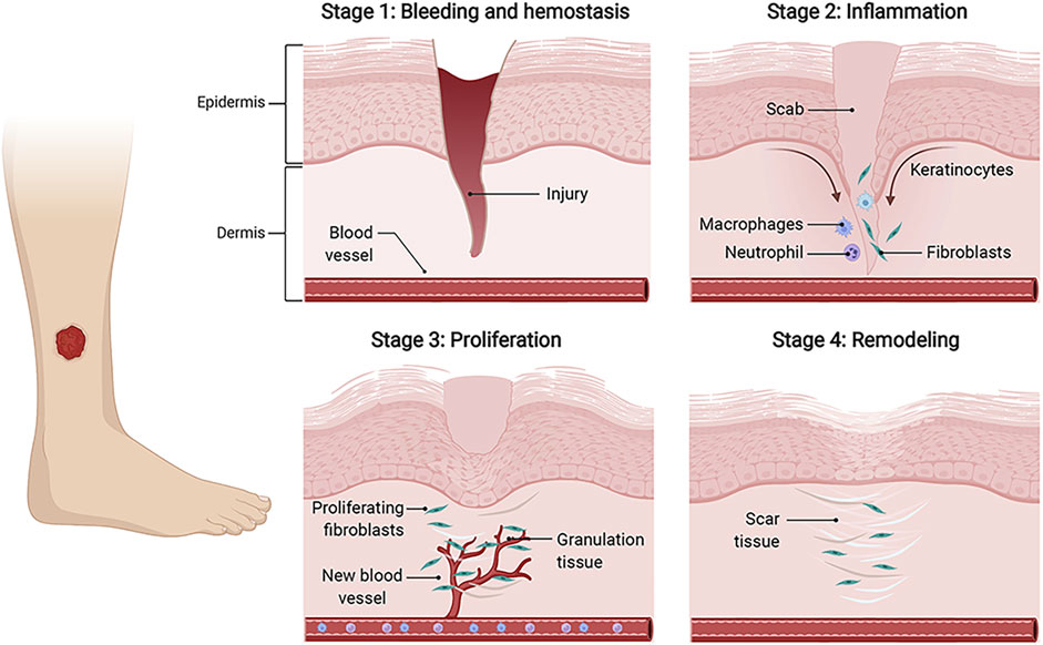Frontiers | Landscape of the epigenetic regulation in wound Frontiers | Landscape of the epigenetic regulation in wound