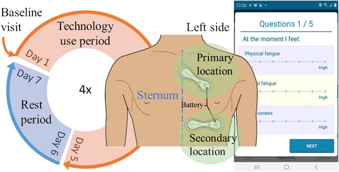 Assessing fatigue and sleep in chronic diseases using physiological signals from wearables: A pilot study